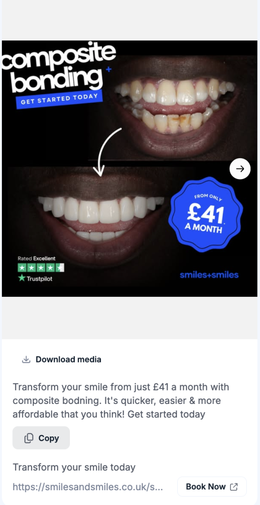 Smiles+Smiles Facebook ad showing a before-and-after composite bonding result with a Book Now call to action.