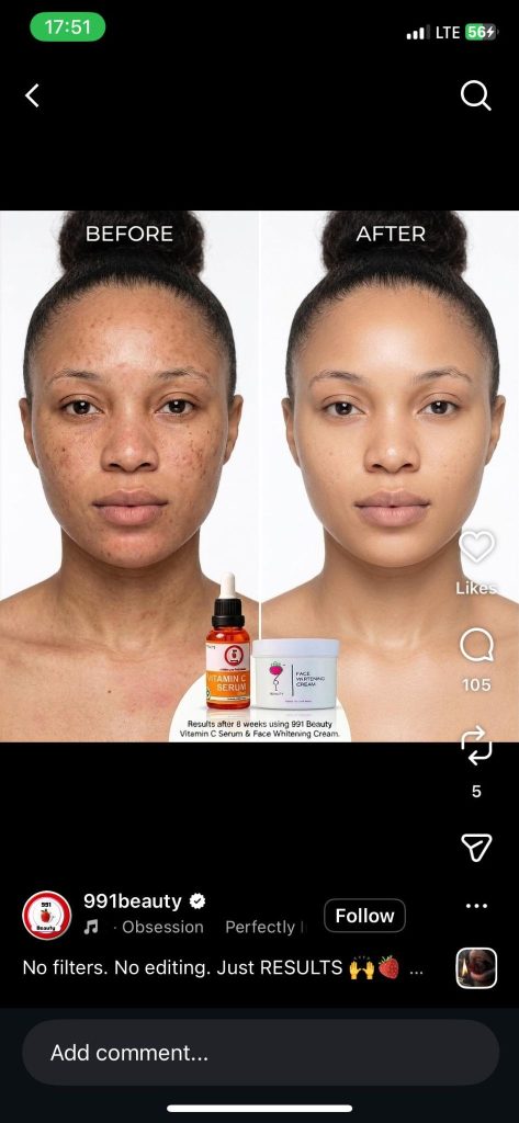 991 Beauty Instagram ad featuring a before-and-after split frame showing skin transformation results.
