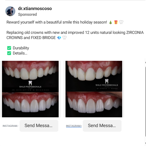 Instagram ad from Dr. Xtianmoscoso featuring before-and-after dental crown results with Send Message CTAs.