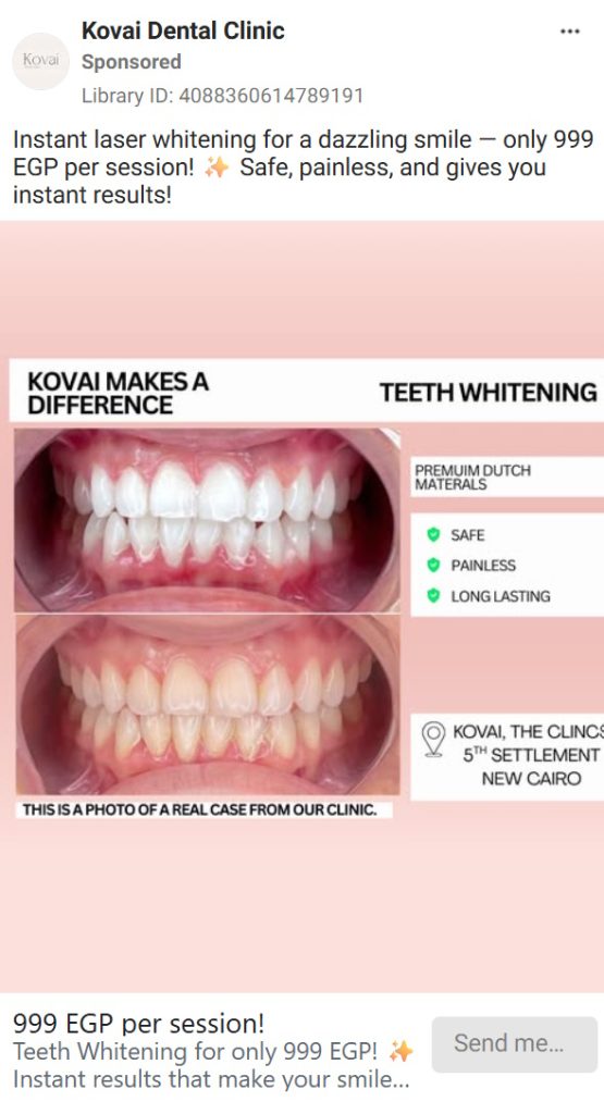 Before-and-after close-up of a patient's smile showing the result of Invisalign.