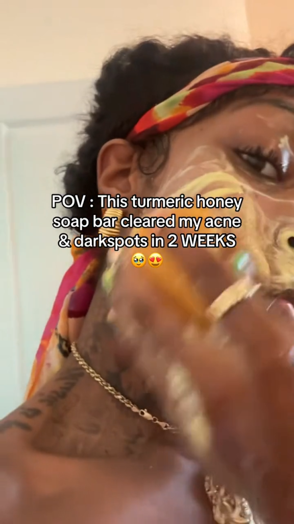 POV-style TikTok skincare ad featuring a creator describing how the product cleared her acne and dark spots in two weeks.