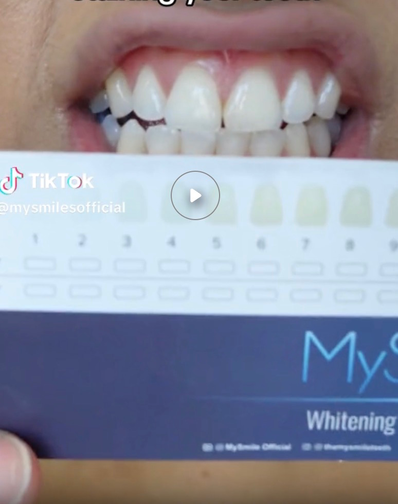 Person smiles while holding a MySmile whitening shade guide in a TikTok video.